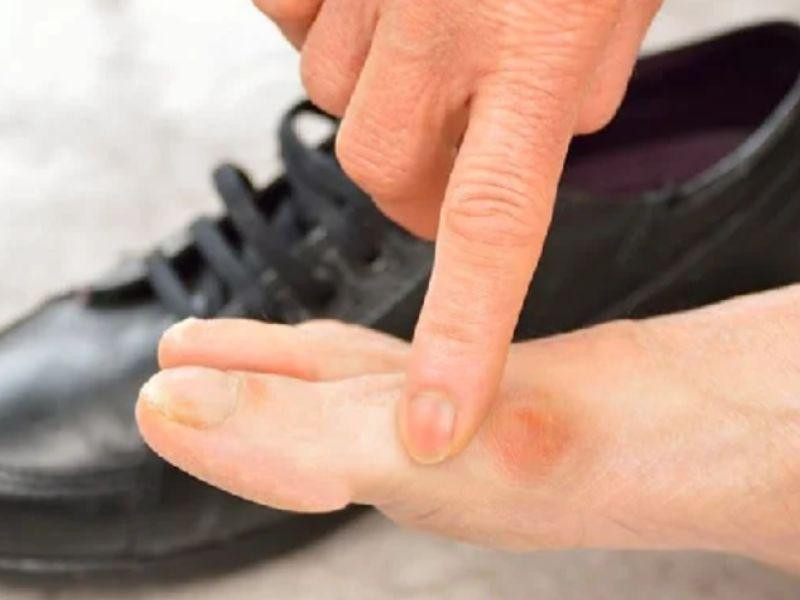 ảnh hưởng của giày cứng đến bàn chân khi tìm cách làm mềm giày sneaker