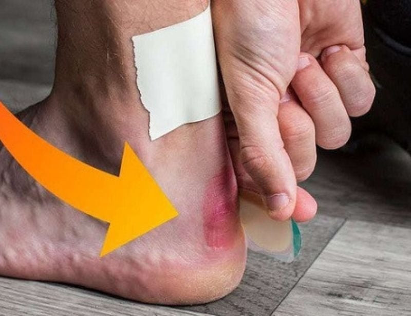 Băng dán thể thao hỗ trợ giảm đau gót chân khi đi giày đá bóng