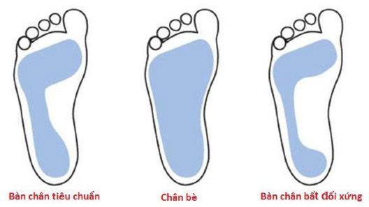 Hình ảnh minh họa các dạng bàn chân: thon, tiêu chuẩn và bè