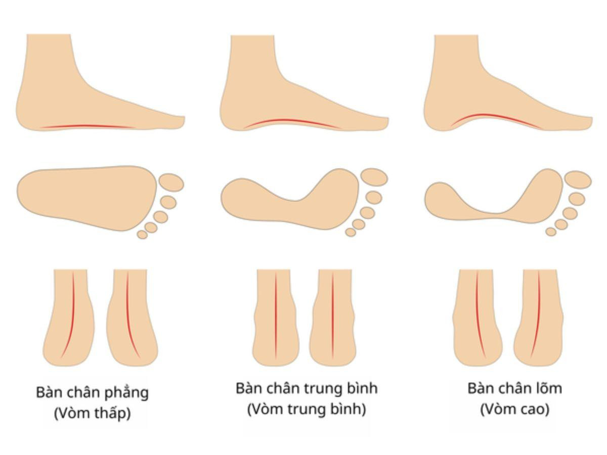 Xác định đúng form chân để chọn giày đá bóng sân cỏ nhân tạo phù hợp