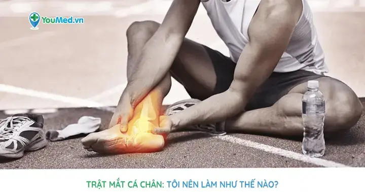 Bị Chệch Mắt Cá Chân Do Đi Giày Cao: Nguyên Nhân, Cách Xử Lý Và Phòng Ngừa Hiệu Quả