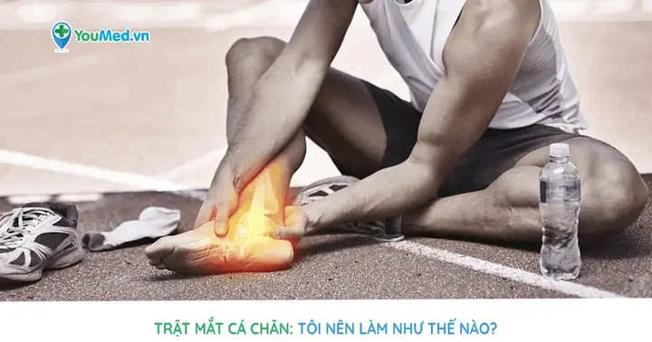 Bị Chệch Mắt Cá Chân Do Đi Giày Cao: Nguyên Nhân, Cách Xử Lý Và Phòng Ngừa Hiệu Quả