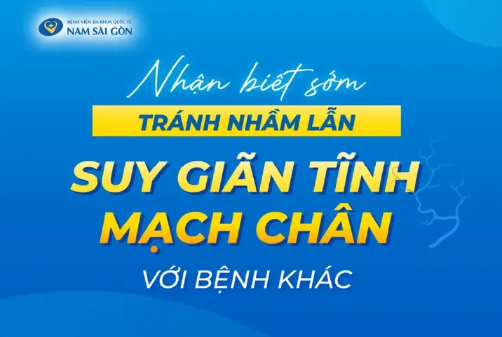 Bị Giãn Tĩnh Mạch Chân Có Nên Mang Giày?