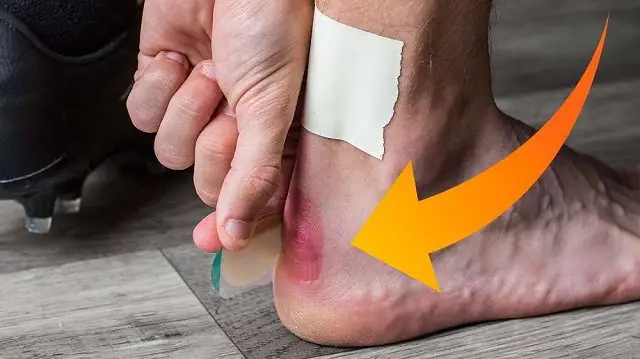 Cách Đỡ Đau Chân Khi Mặc Giày Bóng Đá