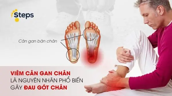 Bí Quyết Giảm Đau Gót Chân Khi Mang Giày Cao Gót: Cẩm Nang Toàn Diện Từ A-z