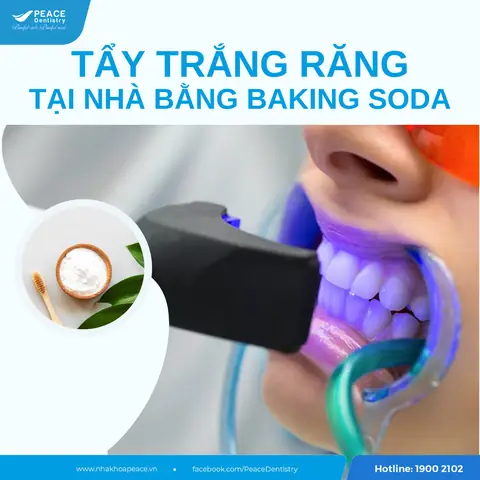 Cách Sử Dụng Thuốc Tẩy Trắng Giày Peac Chuẩn Nhất Từ A Đến Z