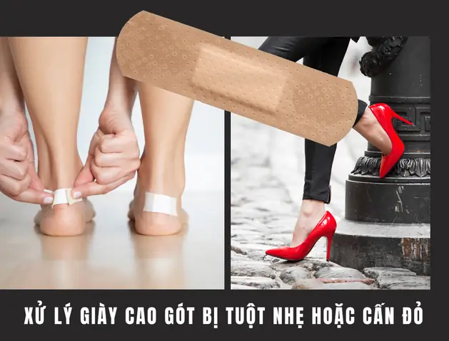 5+ Cách Xử Lý Giày Cao Gót Bị Rộng Đơn Giản Tại Nhà