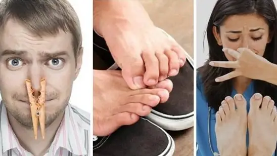 Chân Đi Tất Giày Nhiều Ngứa Kẽ Chân: Nguyên Nhân Và Cách Xử Lý Dứt Điểm