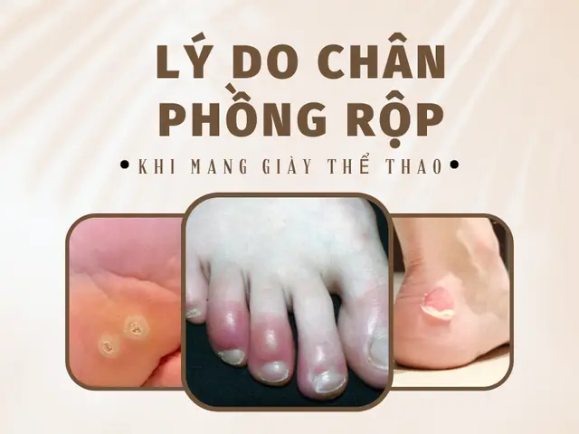 Top 5 Kiểu Giày Thể Thao Tốt Nhất Cho Người Chân To: Giải Pháp Nâng Đỡ Và Thoải Mái Tối Ưu