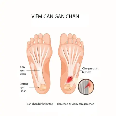 Hướng Dẫn Chi Tiết Cách Chọn Giày Cao Gót Phù Hợp Cho Cân Nặng
