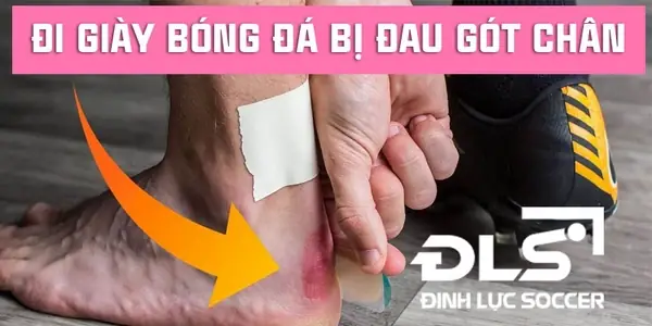 Đi Giày Đá Bóng Bị Trầy Gót Chân: Nguyên Nhân Và Cách Xử Lý Hiệu Quả