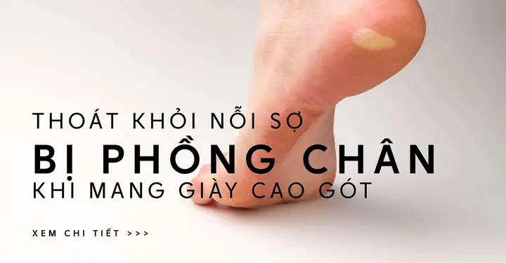 Cách Trị Phồng Chân Khi Mang Giày Cao Gót: Hướng Dẫn Toàn Diện
