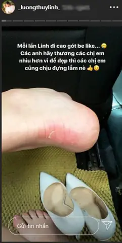 Chân Bị Xước Do Đi Giày Cao Gót: Nguyên Nhân, Cách Xử Lý Và Phòng Ngừa Hiệu Quả